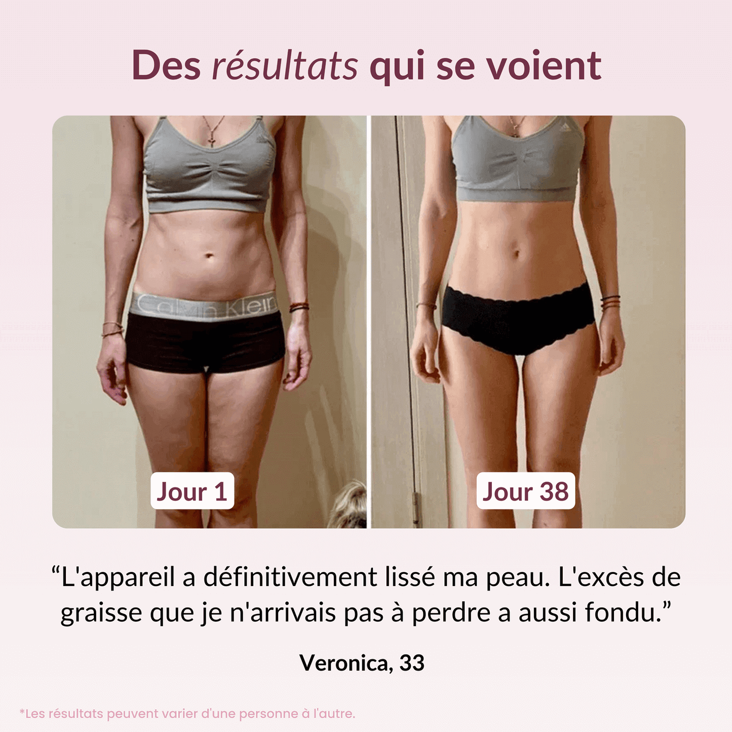 Appareil sulptant Syvela™