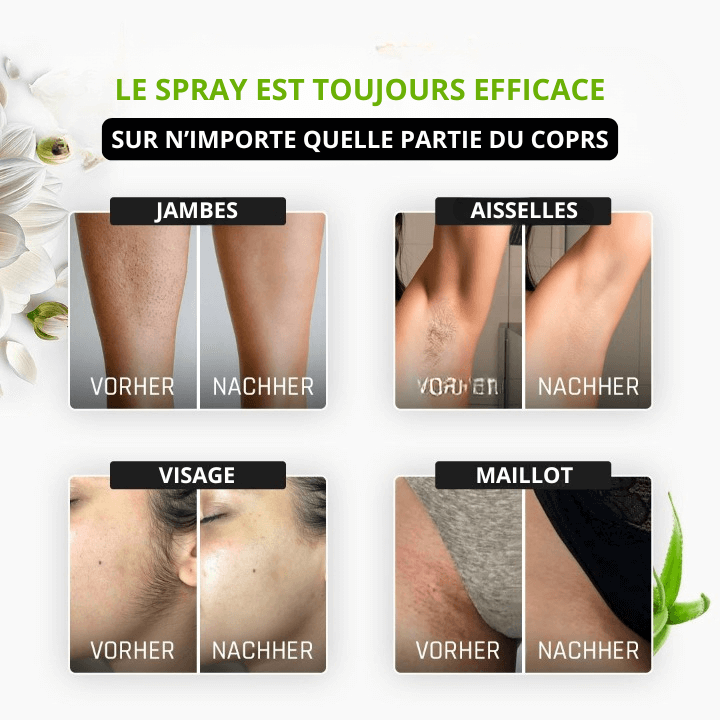HairX™ - Le spray épilatoire à l'aloe vera