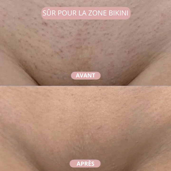 SKINOVA™ – Kit de rasage 5-en-1