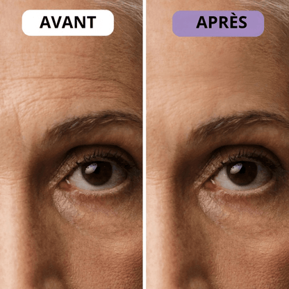 Ondine™ – Patchs anti-rides & cicatrices