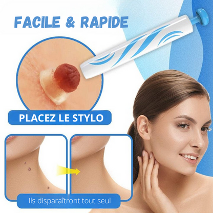 MySkin™ - Kit de Suppression des Acrochordons