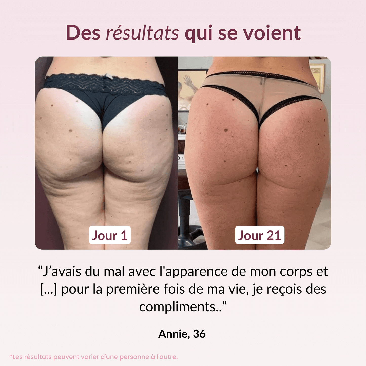 Appareil sulptant Syvela™