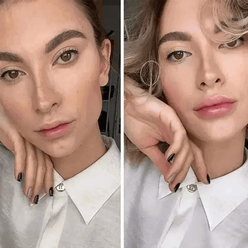 LipRush™ –  Microneedling Lèvres