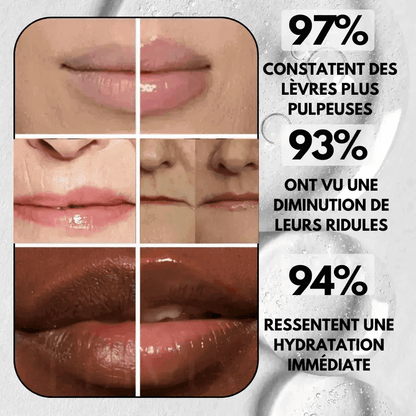 LipRush™ –  Microneedling Lèvres