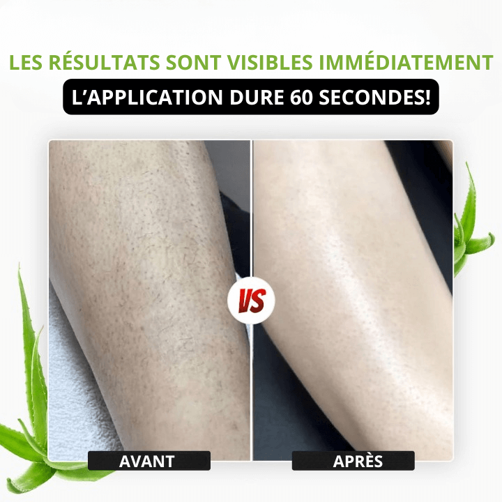 HairX™ - Le spray épilatoire à l'aloe vera