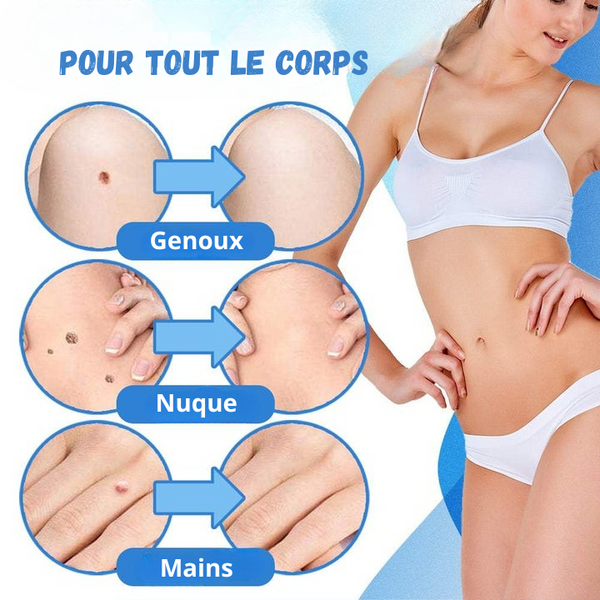 MySkin™ - Kit de Suppression des Acrochordons