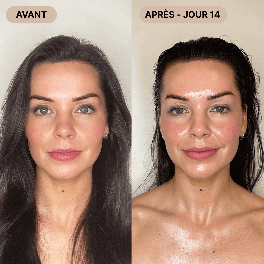 Lifting Facial Oralis™