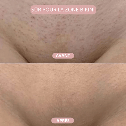 SKINOVA™ – Kit de rasage 5-en-1