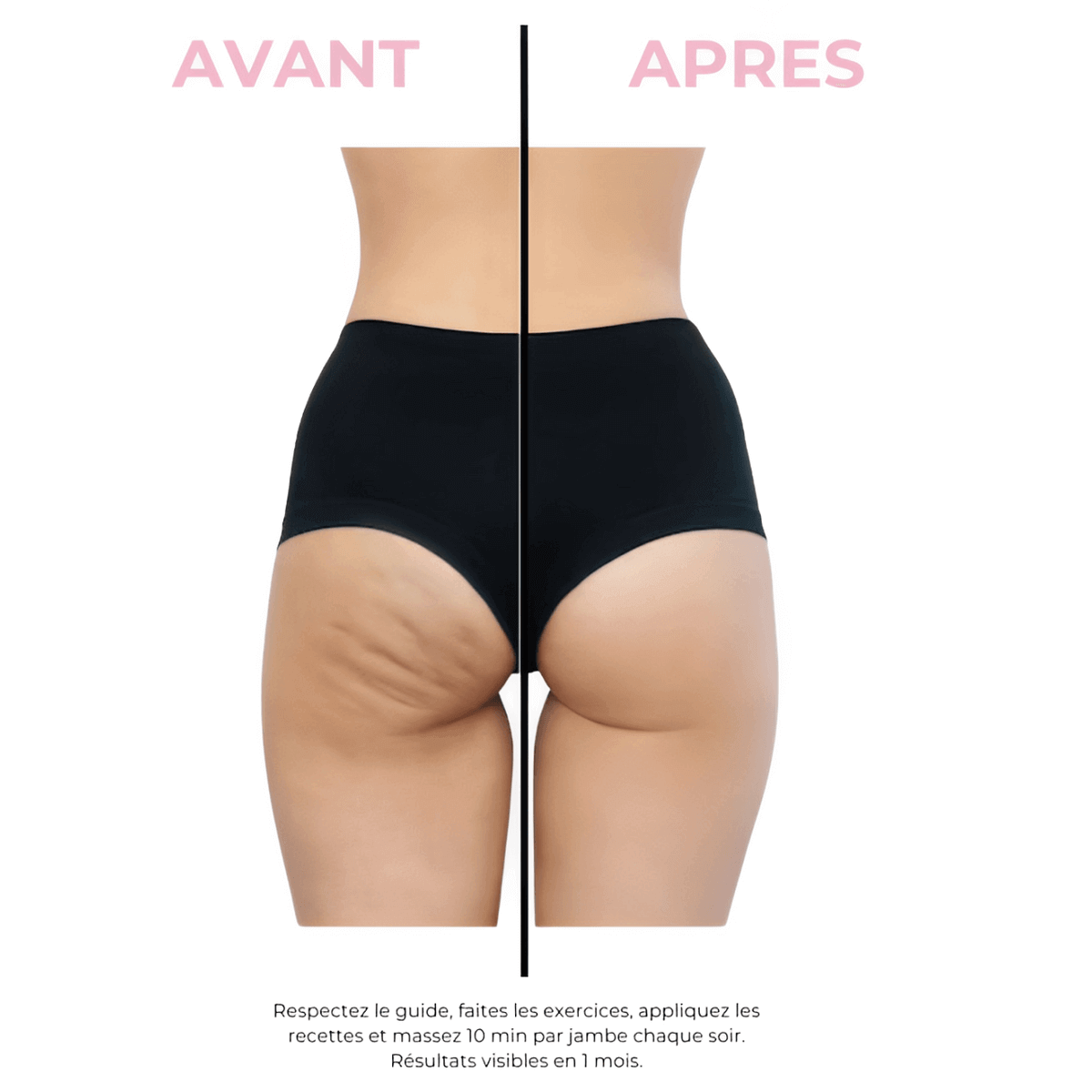 Masseur Anti-Cellulite Orélia™