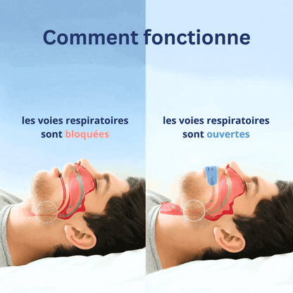 Somnex™ – Orthèse universelle anti-ronflement